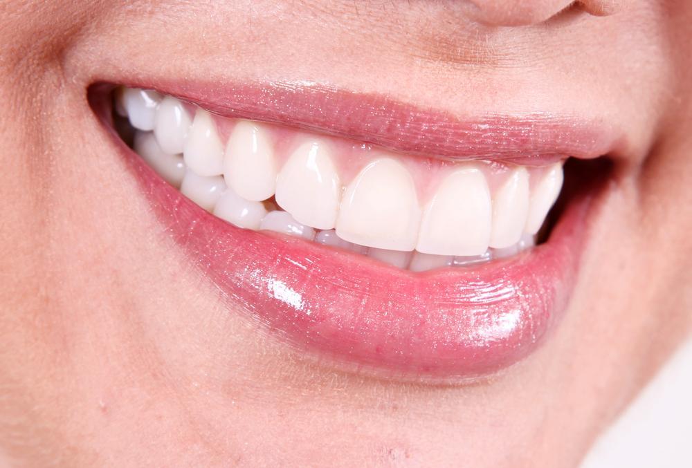 How to Maintain Professional Whitening Results?