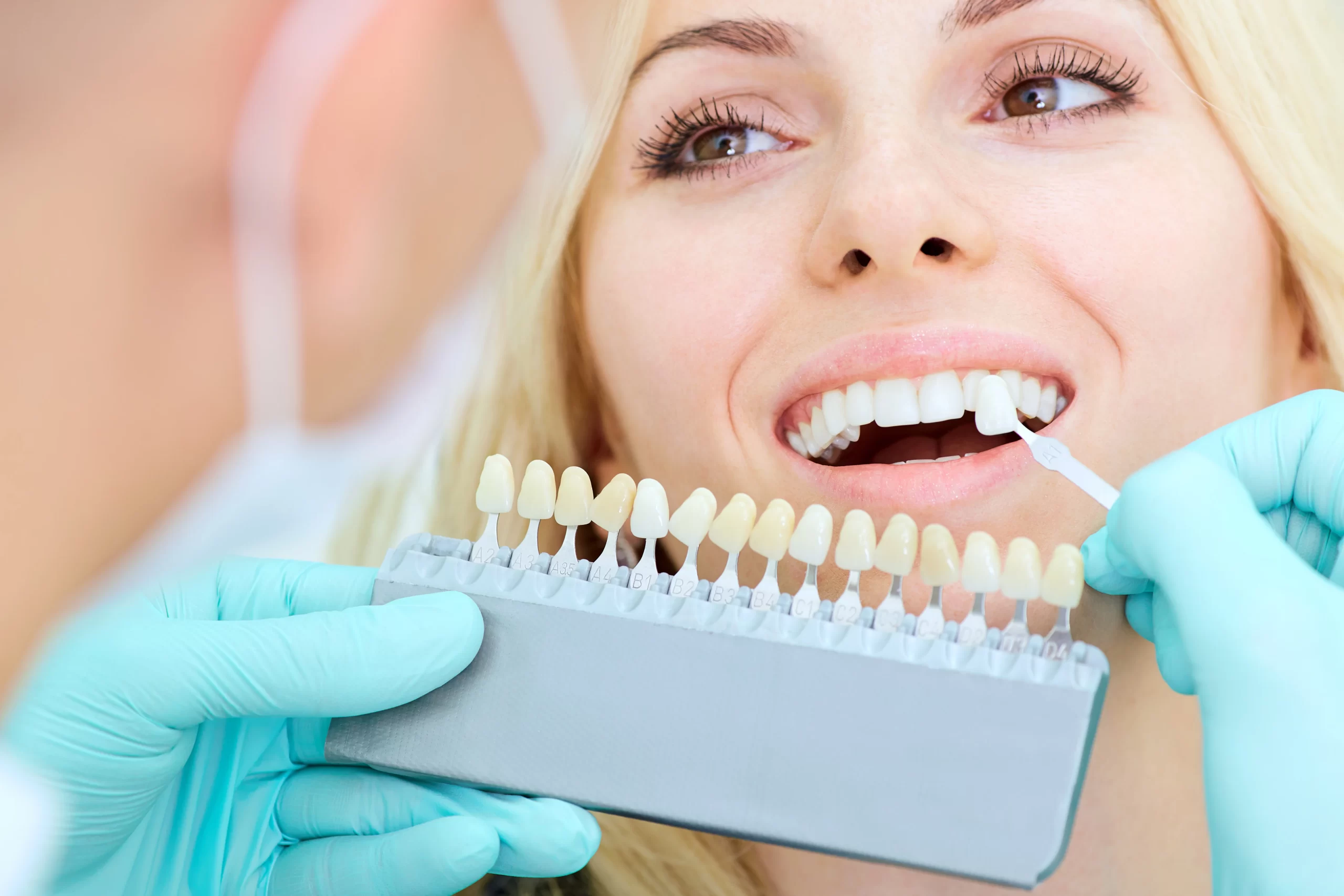 Step-by-Step Guide: The Science Behind In-Office Teeth Whitening