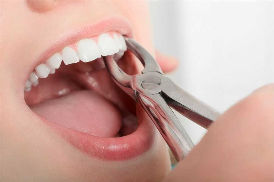 Things You Should Know About Before Considering Tooth Extraction